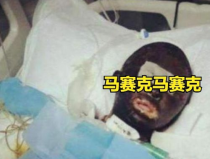 烧死的网红,揭秘网红烧身悲剧背后的真相